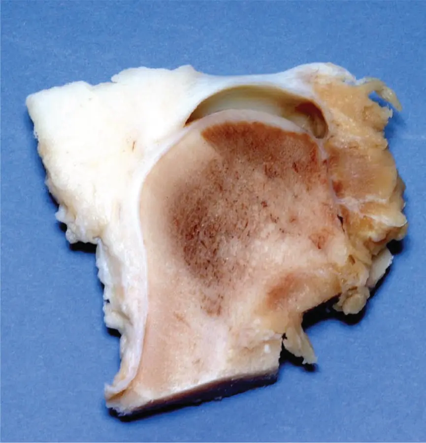 Figure 27Sagittal section of porcine temporomandibular joint As in human - фото 18