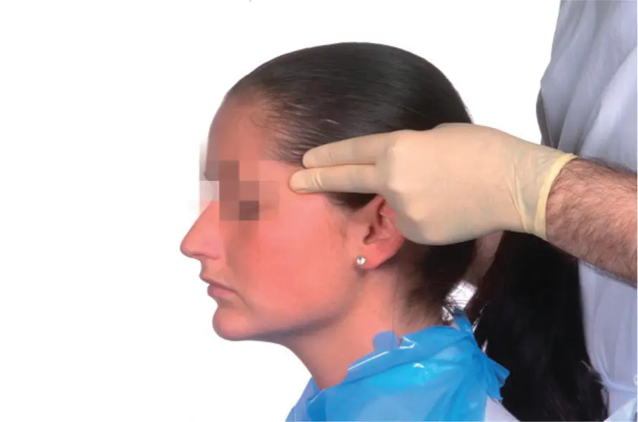 Figure 39Palpation of the anterior vertical fibres of the temporalis M Ziad - фото 50