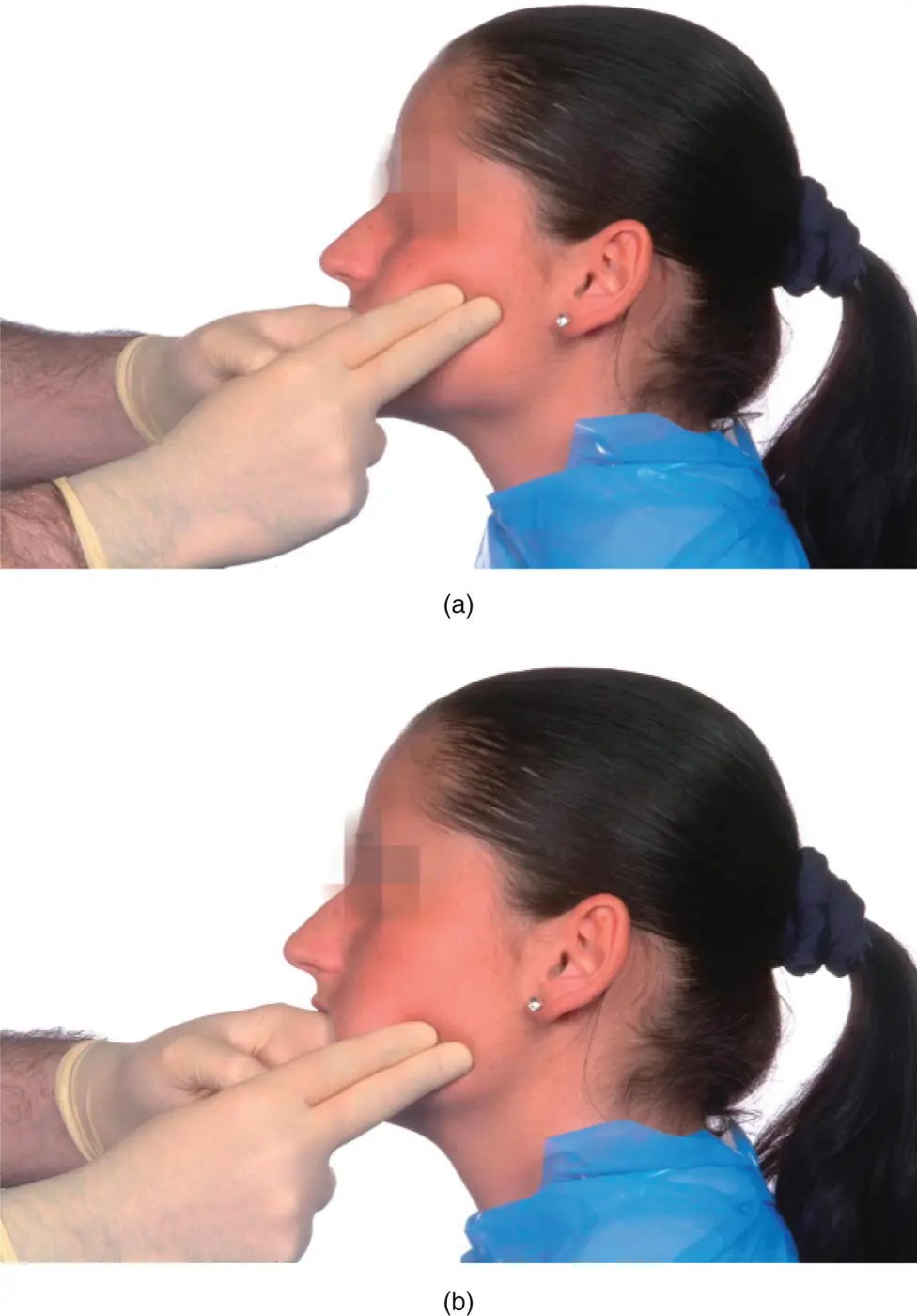 Figure 38a Palpation of the origin and b insertion of the masseter M - фото 49