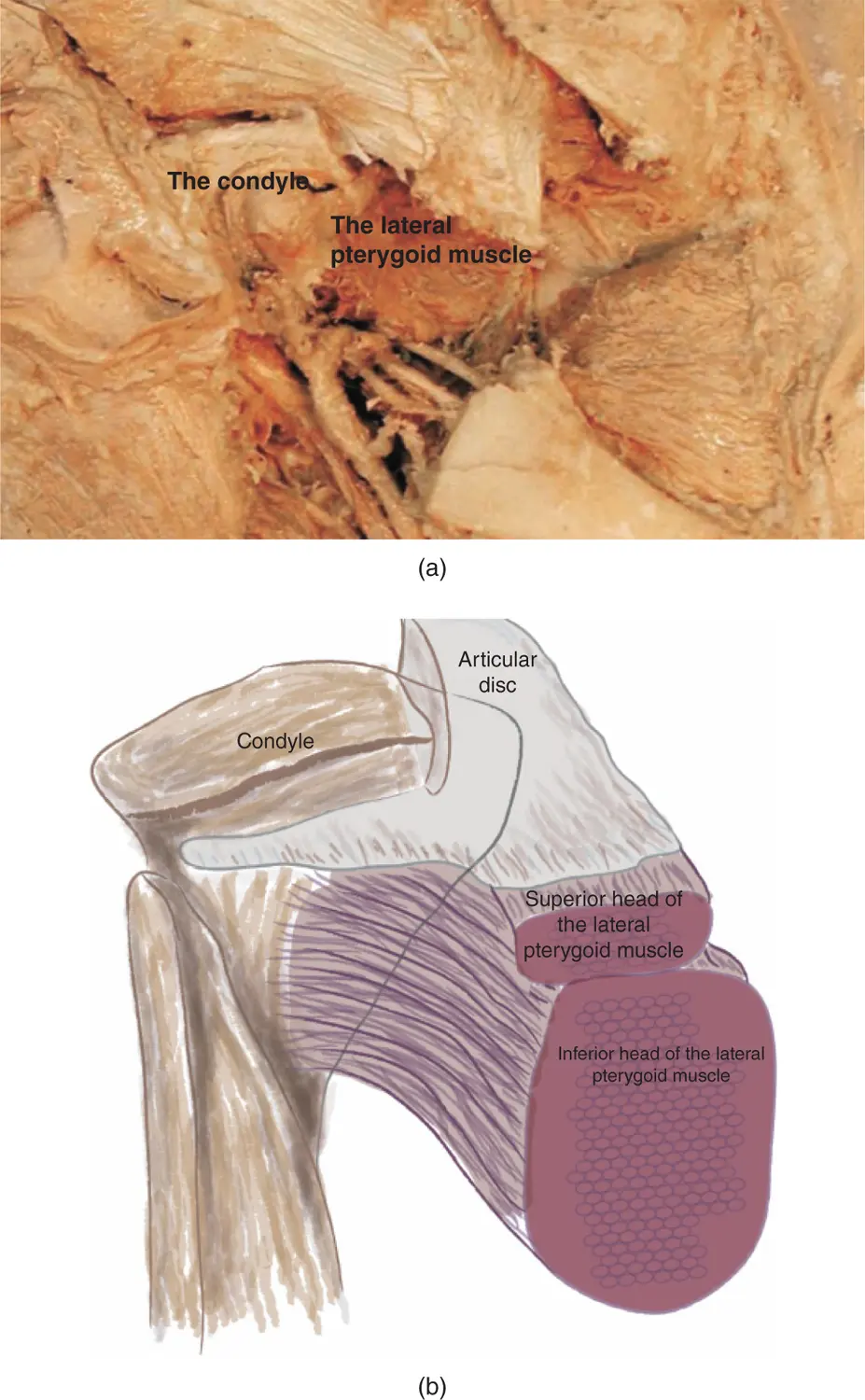 Figure 212The lateral pterygoid muscle a Courtesy of Dr Paul Rea and - фото 25