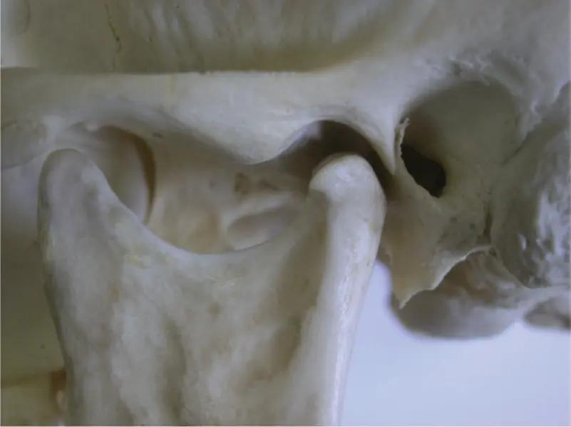 Figure 21The temporomandibular joint M Ziad AlAni Robin JM Gray - фото 10