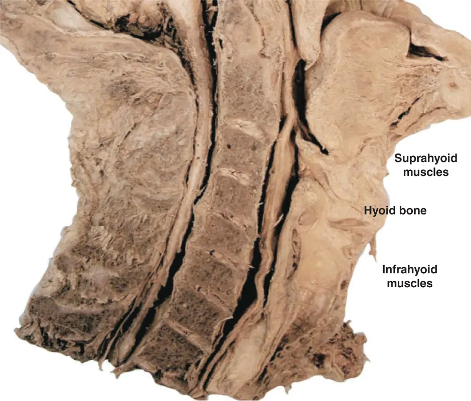 Figure 216The infrahyoid and suprahyoid muscles Courtesy of Dr Paul Rea and - фото 29