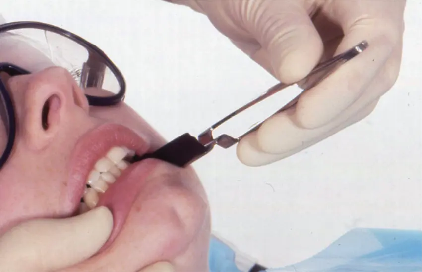 Figure 316Determination of anterior guidance M Ziad AlAni Robin JM - фото 64