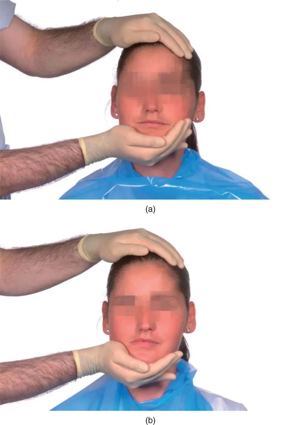 Figure 310a Examination of lateral pterygoid muscle against vertical - фото 51