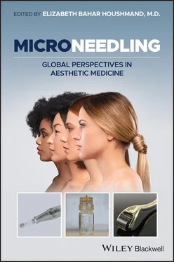 Неизвестный Автор Microneedling обложка книги