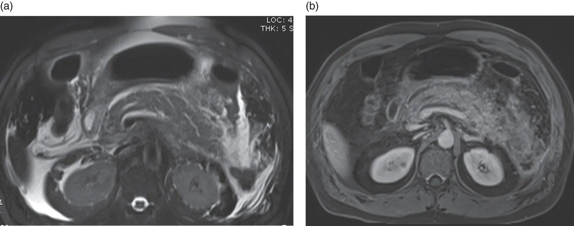 Figure 61 A 44yearold male presents with acute onset of severe abdominal - фото 10