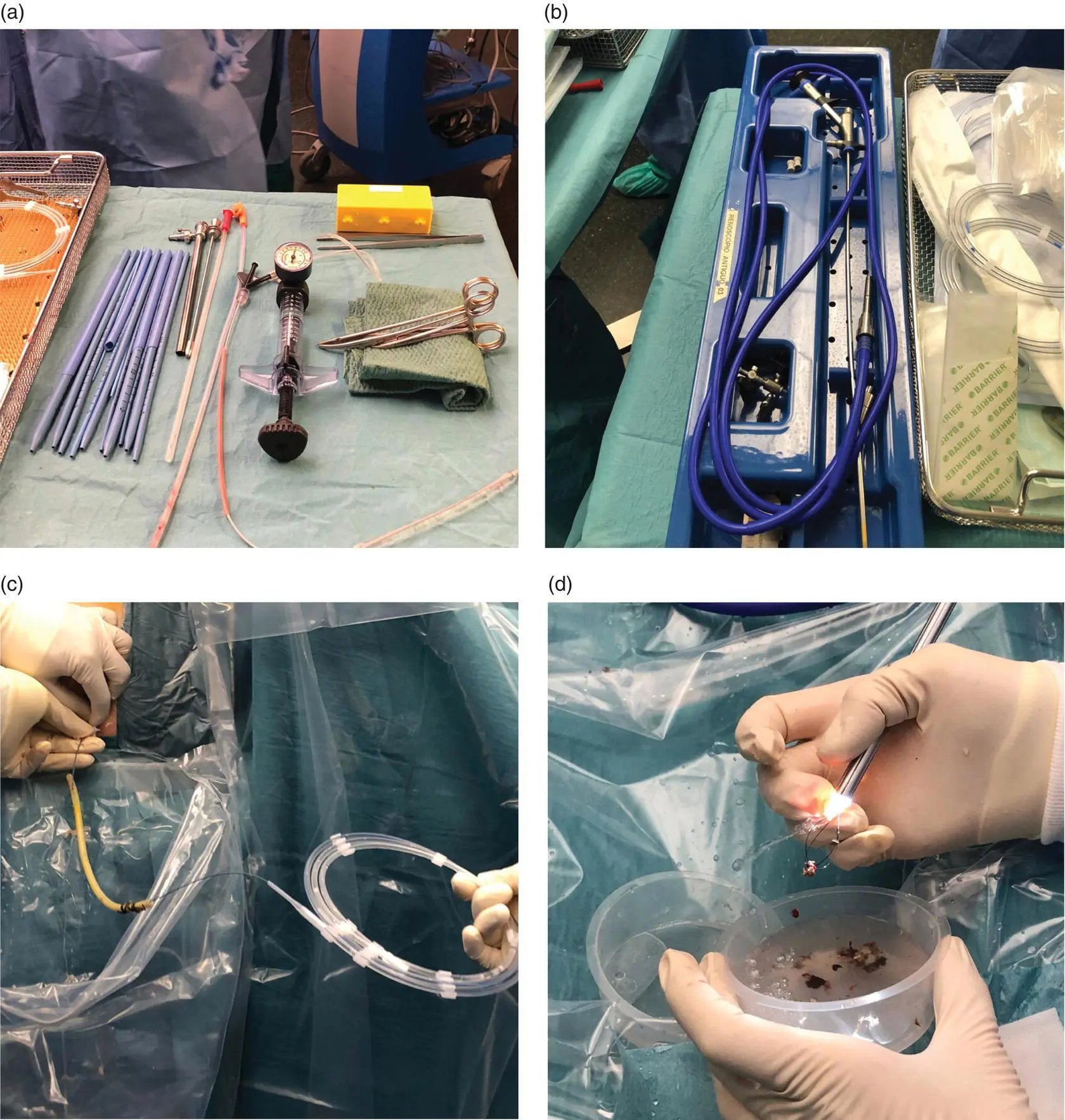 Figure 151 a b Amplatz and dilatators used to dilate the drainage tract and - фото 21