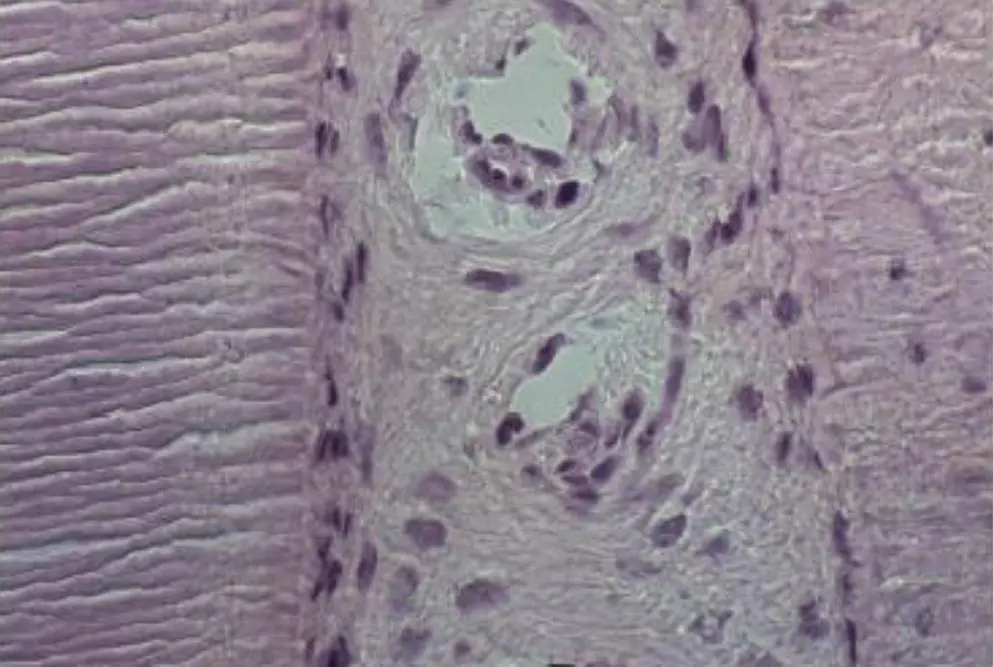 Figure 112 A 6 μm sagittal section of a frozen unfixed nondemineralized cat - фото 13