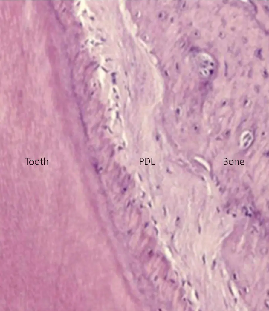 Figure 39 Photomicrograph of the PDL after orthodontic force application for - фото 56