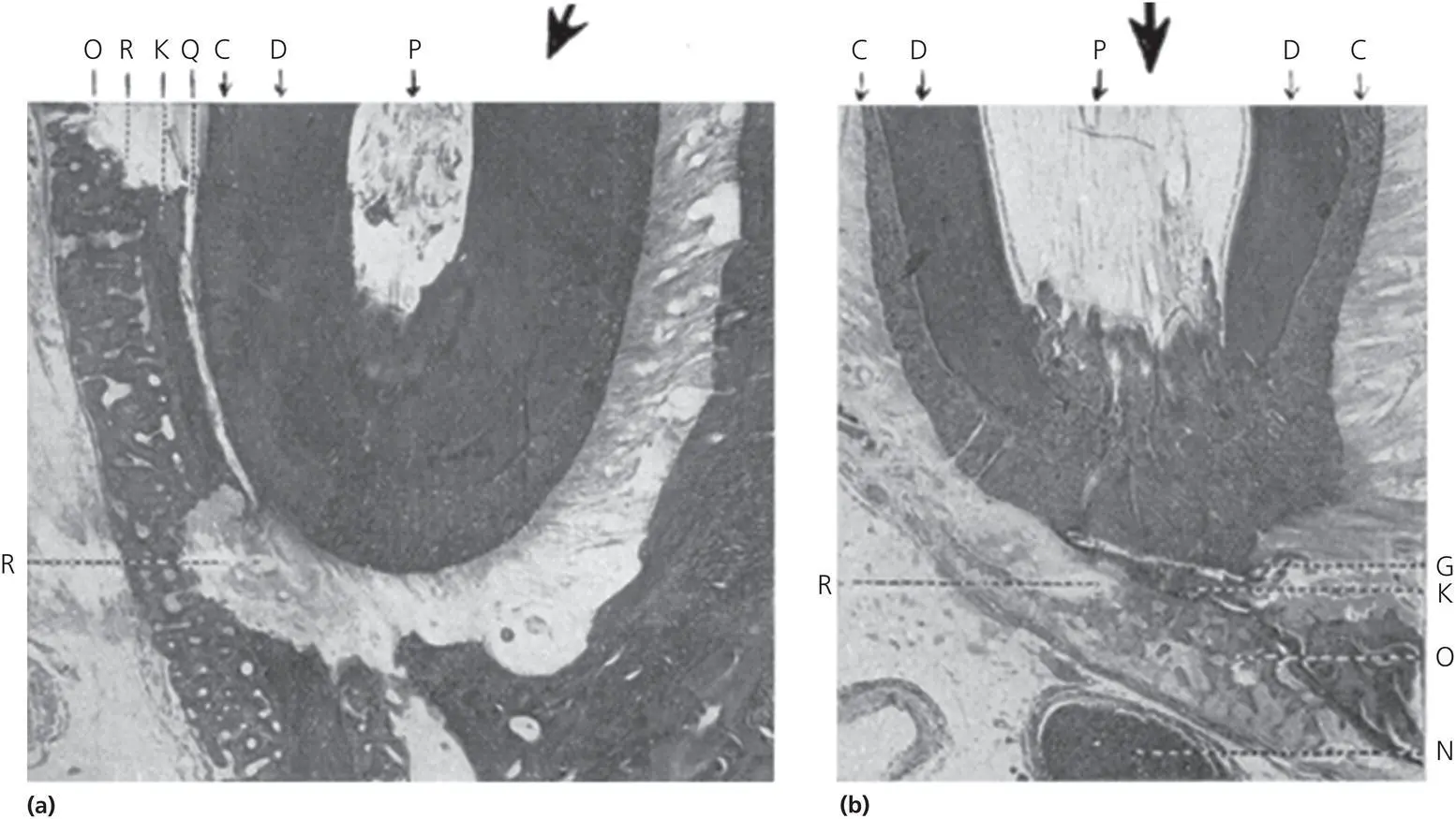 Figure 210 Fourth degree of biologic effect as portrayed in Schwarz article - фото 32