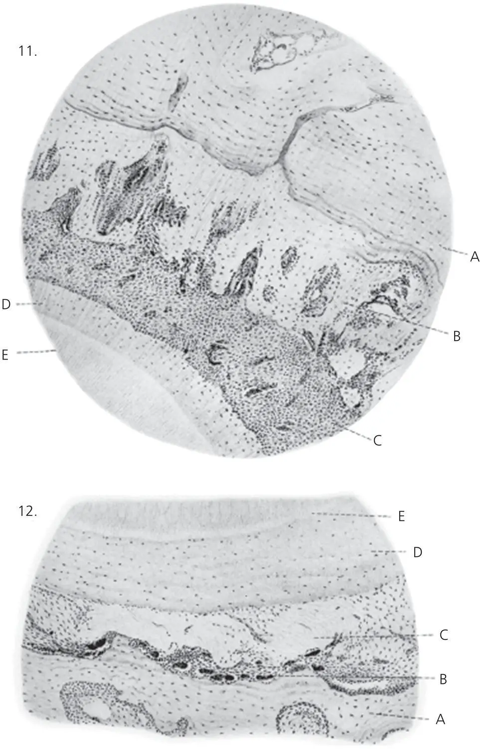 Figure 24 Plate IV A from Sandstedts original article These sections show at - фото 27