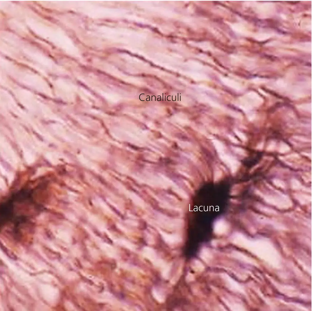Figure 32 Photomicrograph of the bone matrix showing osteocyte lacuna and - фото 49
