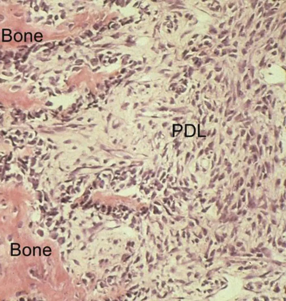 Figure 311 Photomicrograph of the trailing side of orthodontically moving - фото 58