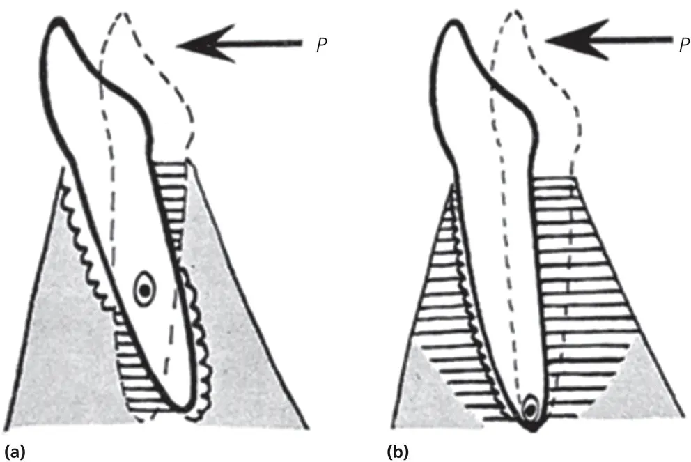 Figure 211 Comparative diagram of the theories put forward by Sandstedt 1904 - фото 33