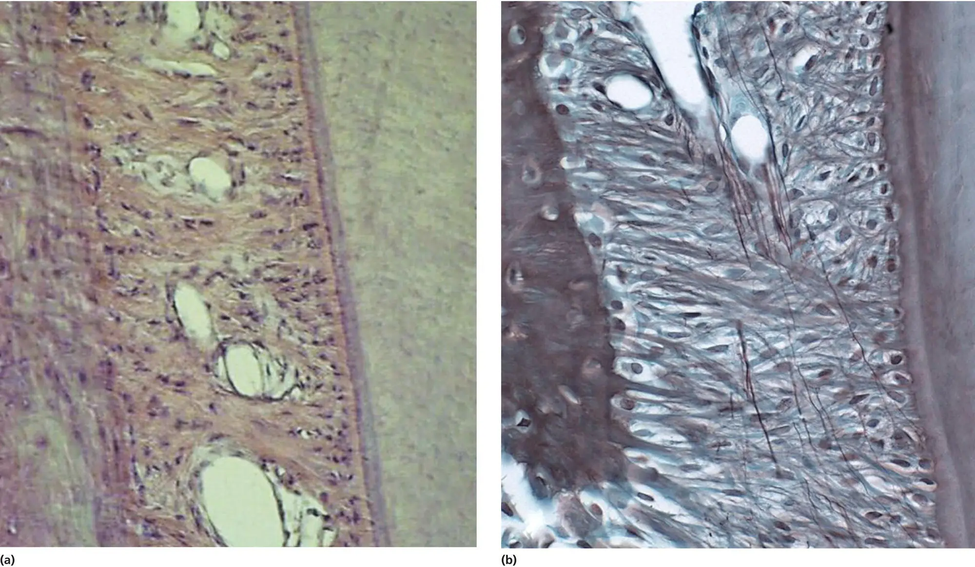 Figure 31 Photomicrographs of the normal PDL in a dog showing the main - фото 48