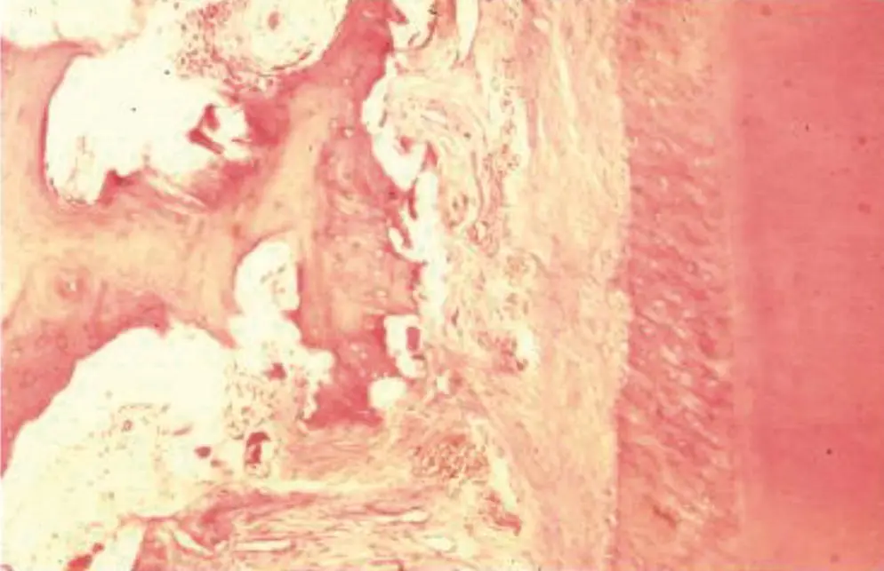 Figure 113 A 6 μm sagittal section of a cat maxillary canine after 28 days of - фото 14