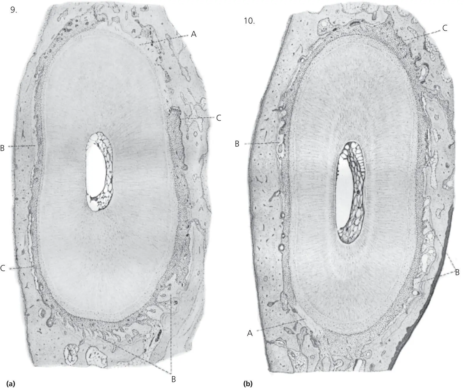 Figure 23 Plate III from Sandstedts original article showing horizontal - фото 26