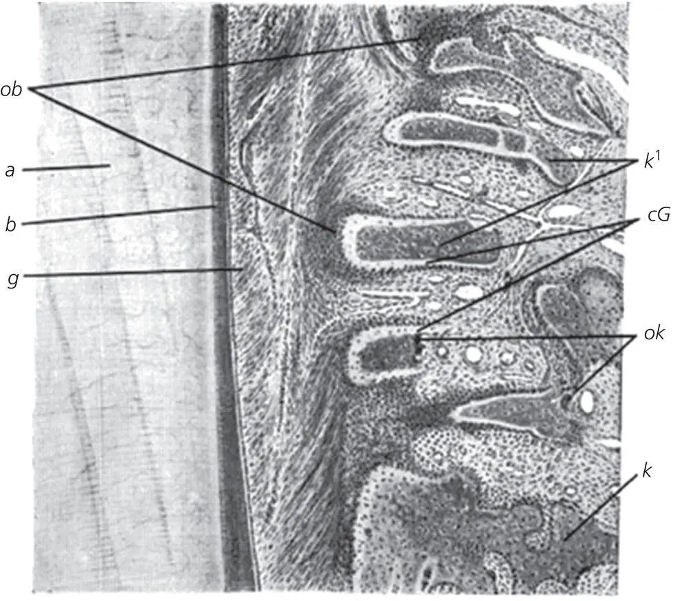 Figure 26 Histologic section from the original article by Oppenheim 1911 - фото 29