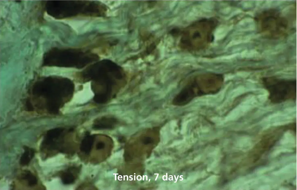 Figure 120 Staining for cyclic AMP in the tension zone of the PDL after 7 days - фото 21