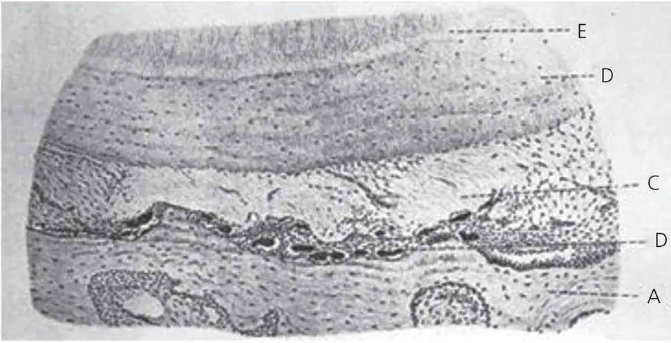 Figure 19 A figure from Carl Sandstedts historical article in 1904 - фото 10