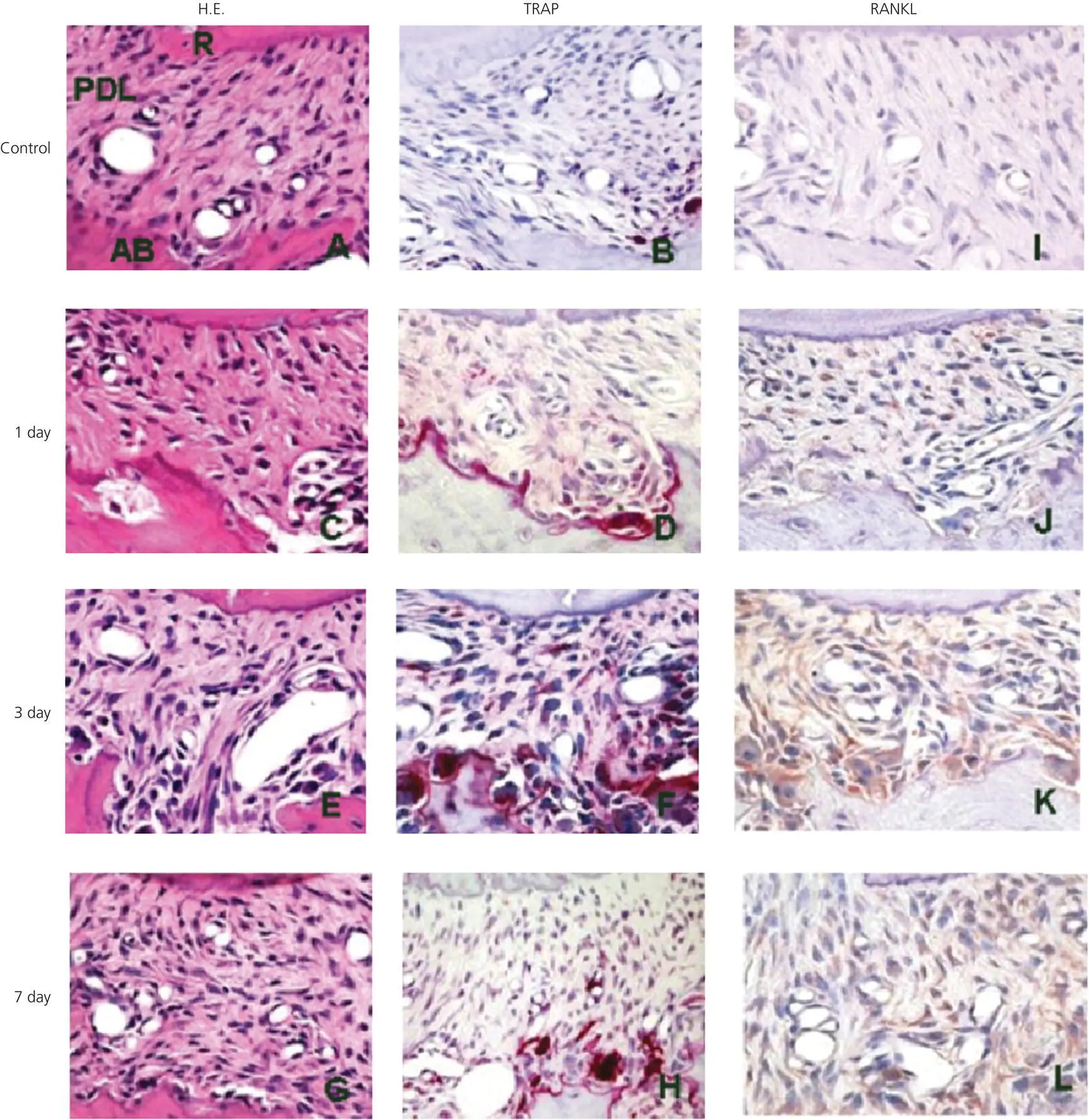 Figure 43 Immunohistochemical staining for RANKL in PDL after 7 days during - фото 66