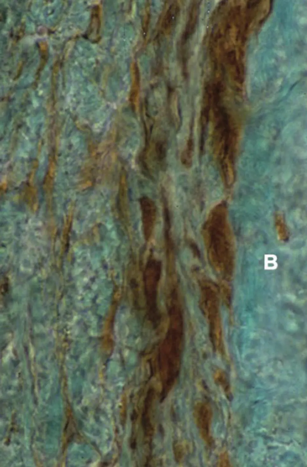 Figure 222 Transverse section 6 μm thick of a 1yearold female cats - фото 45