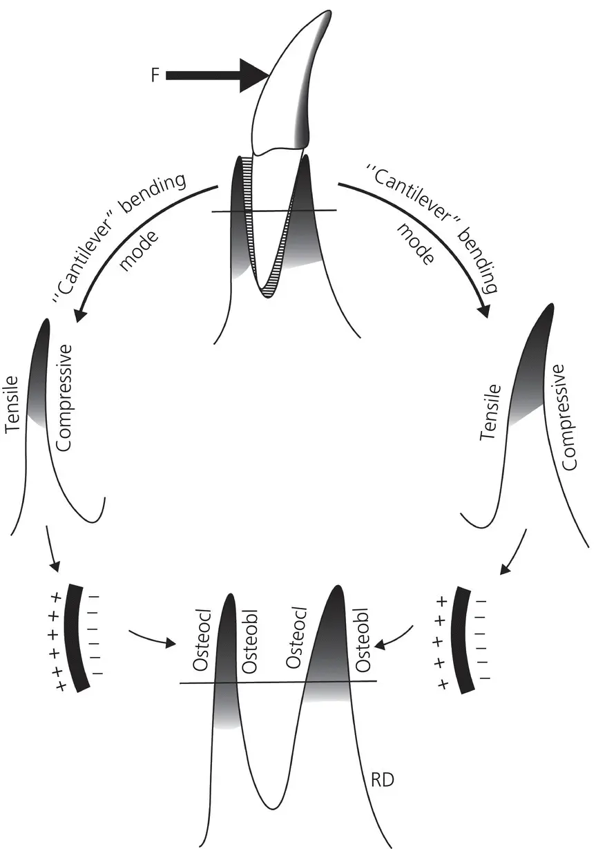 Figure 219 Behavior of bone during orthodontic tooth movement The net force - фото 41