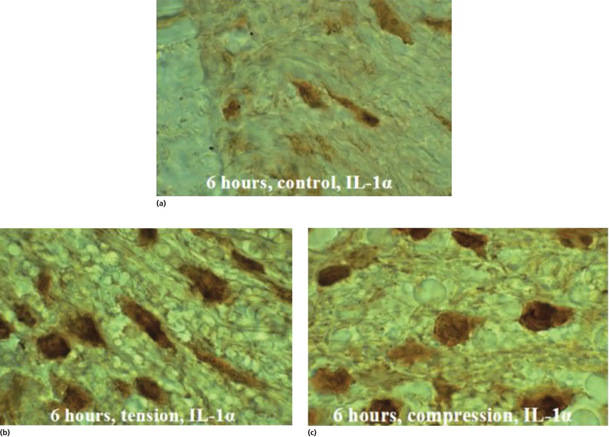 Figure 42 Immunohistochemical localization of the cytokine IL1α in a 6 μm - фото 65