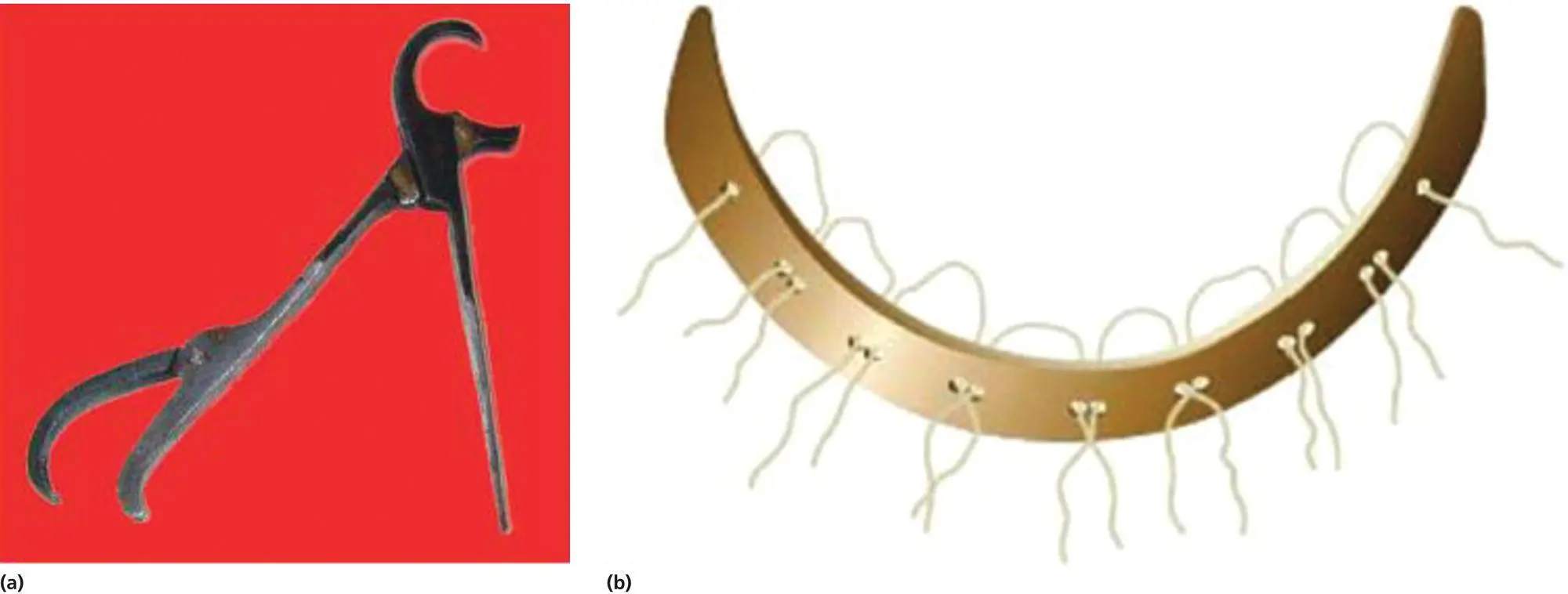 Figure 15 a Dental pelican forceps resembling a pelicans beak Source - фото 6
