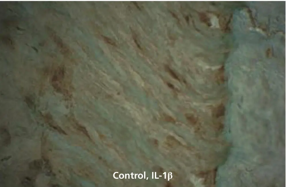 Figure 121 Immunohistochemical staining for IL1β in PDL and alveolar bone - фото 22