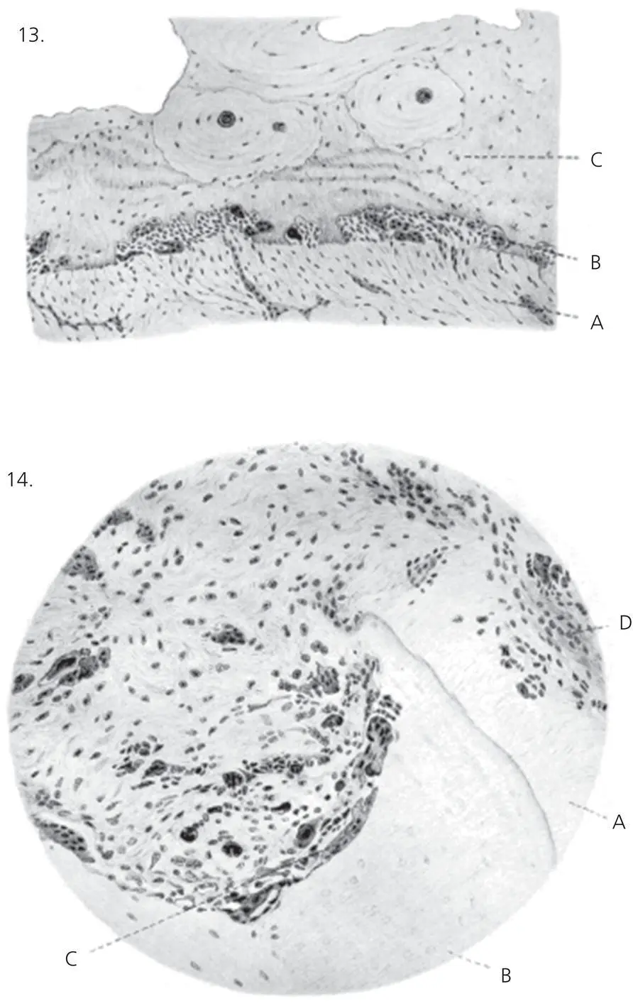 Figure 25 Plate IV B from Sandstedts original article Sandstedts Figure 13 - фото 28