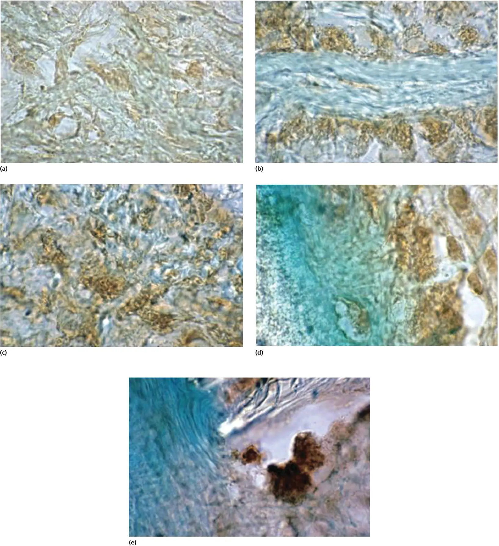 Figure 44 Immunohistochemical staining for CGRP in cat PDL after canine - фото 67