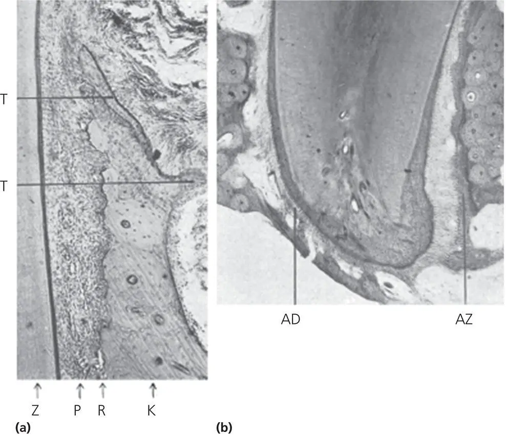 Figure 28 Second degree of biologic effect seen on the a marginal side of - фото 30
