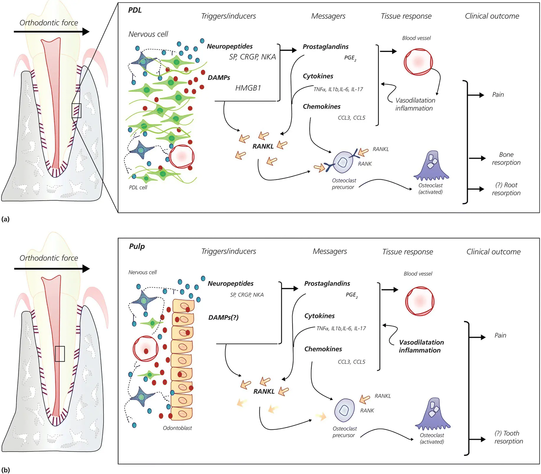 Figure 45 a Schematic presentation of inflammation in the PDL cells - фото 68