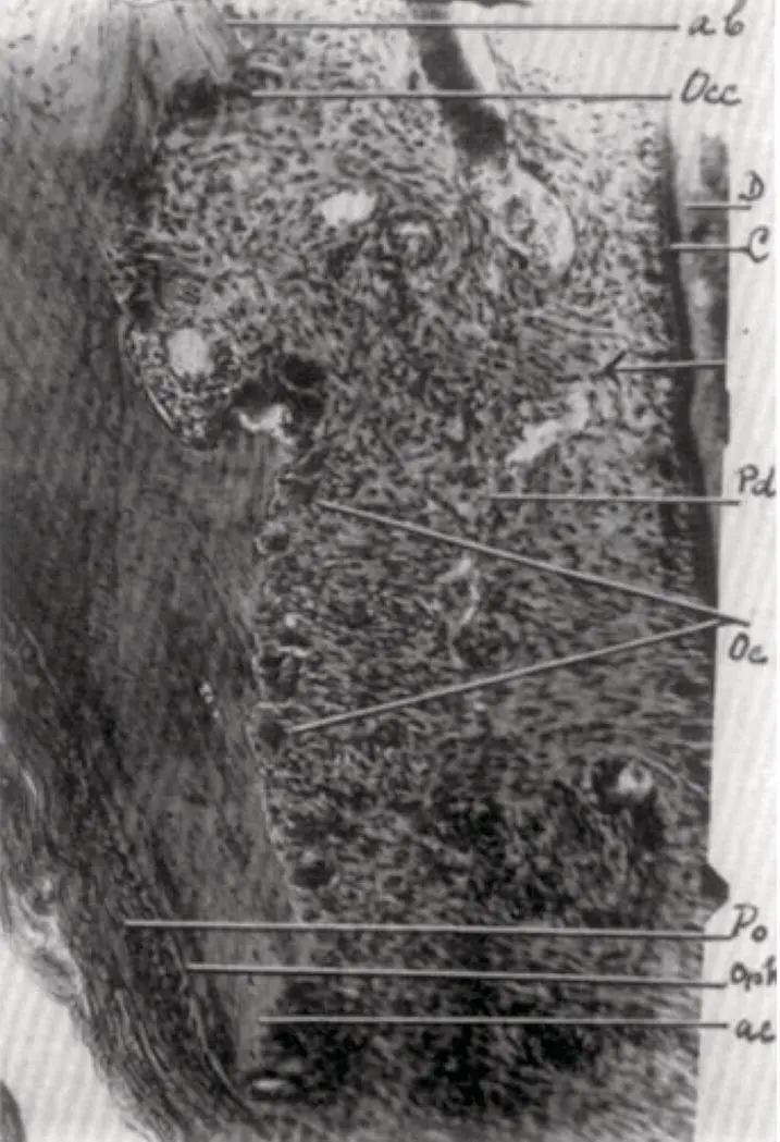Figure 212 Higher magnification image from Oppenheims article 1944 showing - фото 34