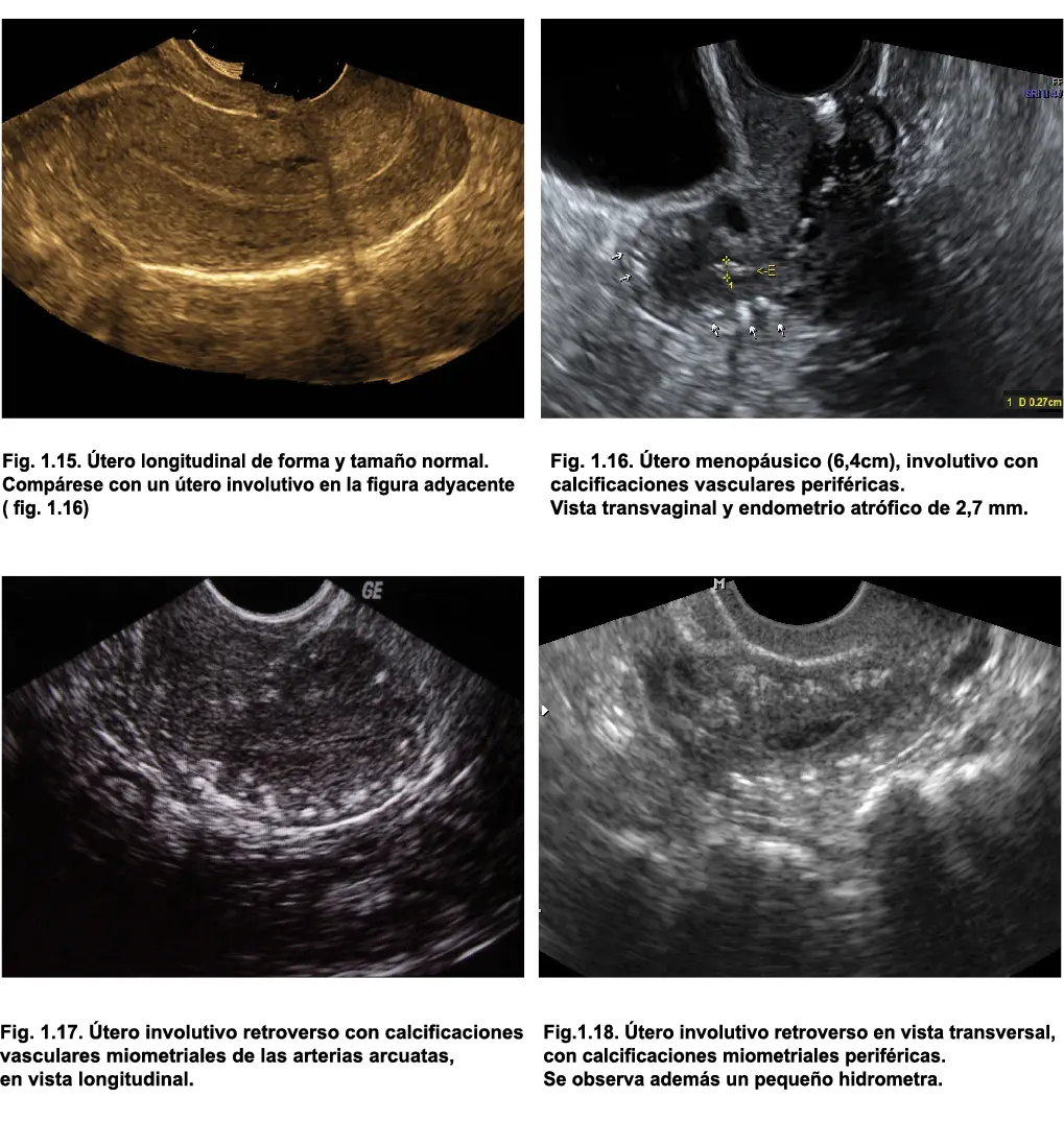 Bibliografía Baltarowich OH 1990 Female pelvic organs measurements In - фото 11