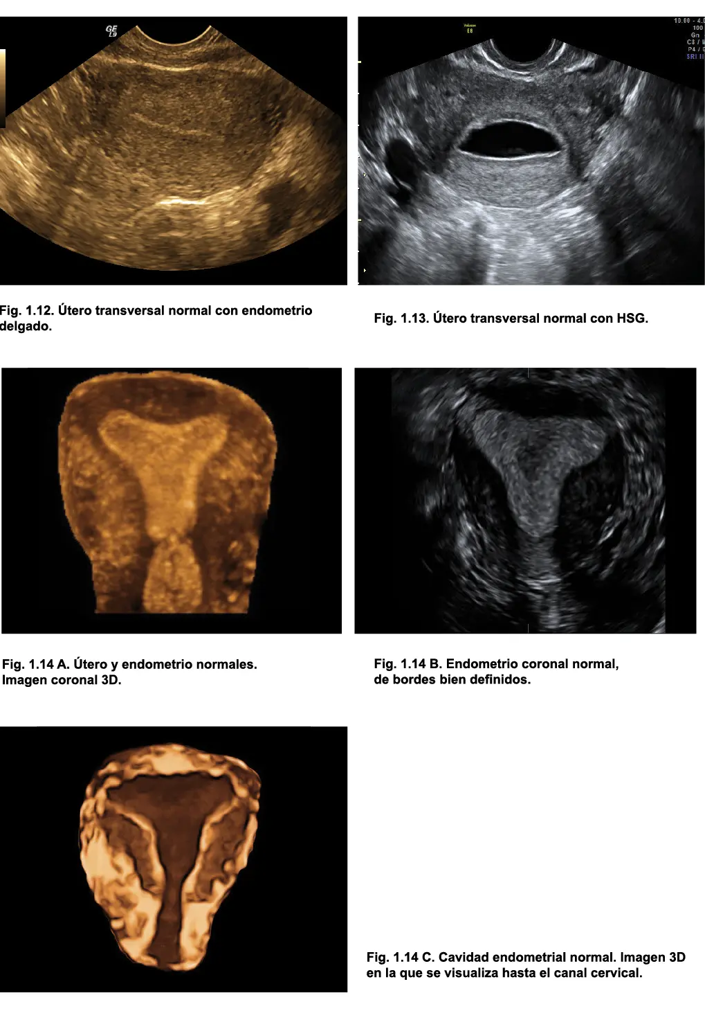 Menopausia El útero sufre atrofia y presenta calcificaciones vasculares - фото 10