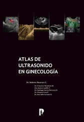 Roberto Moncayo - Atlas de ultrasonido en ginecología