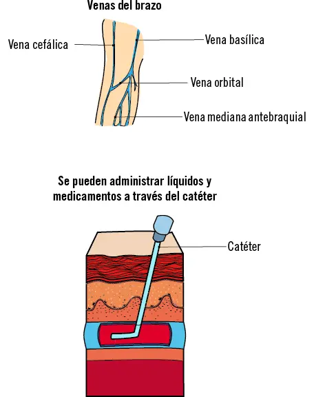 Complicaciones Como cualquier otra técnica la punción de la vena antecubital - фото 11