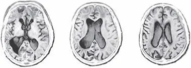 Eine der aufregendsten Beiträge des Neuroimaging besteht darin dass es - фото 3