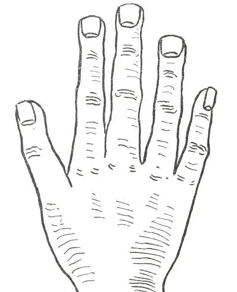 Fig 24 SQUARE HAND In Fig 24 we see the Square Hand the special - фото 26