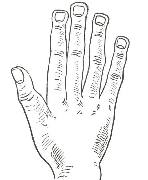 Fig 23 SPATULATE HAND In Fig 23 we see the Spatulate Hand the special - фото 25