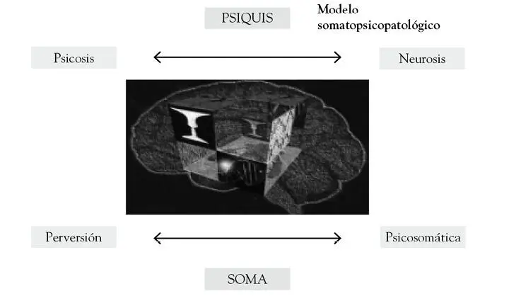 Figura Nº1 Modelo somatopsíquico Es posible posicionar a las pacientes en - фото 3