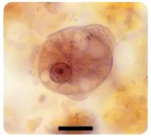 Figura 231 Entamoeba coliTrofozoíto teñido con hematoxilina férrica Se - фото 54