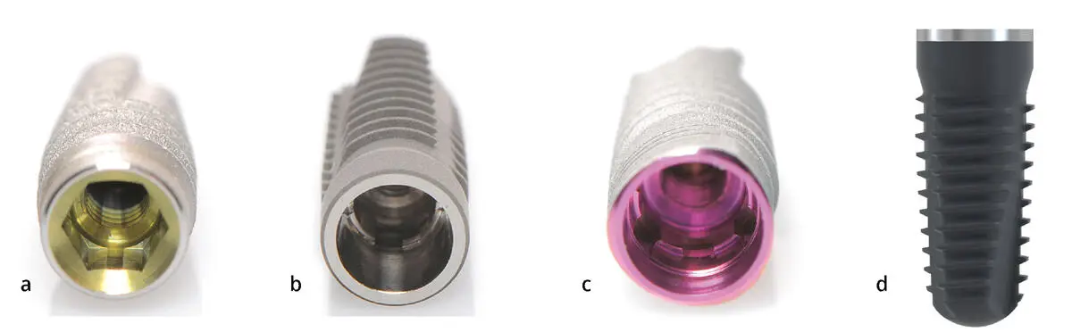 Abb 21Verschiedene Implantatdesigns mit unterschiedlich langem poliertem Hals - фото 40