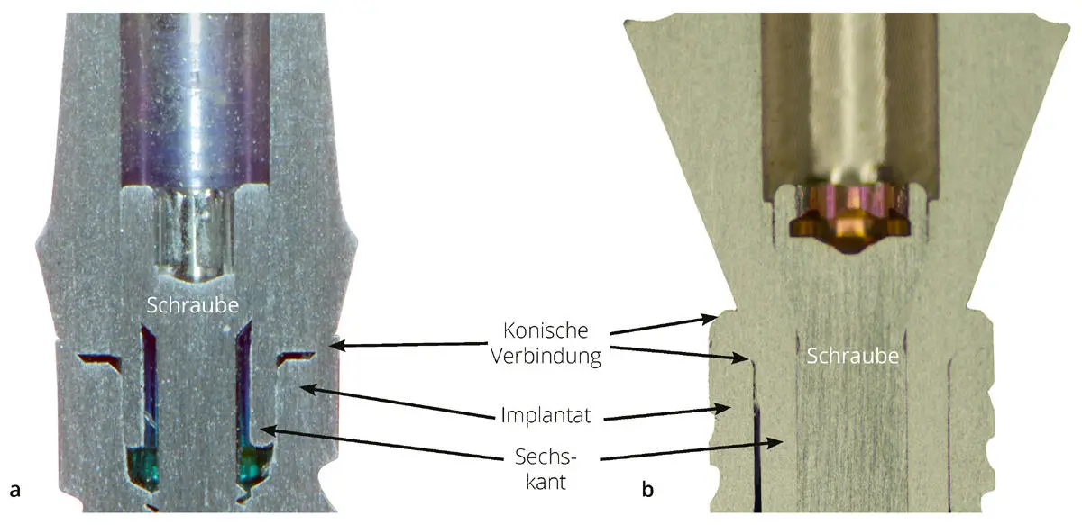 Abb 211Querschnitt der verschiedenen ImplantatAbutmentVerbindungen a - фото 50