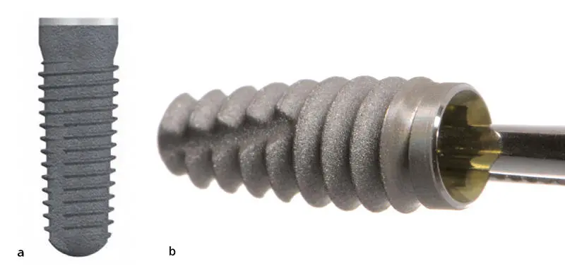 Abb 34Die korrekte Position eines Implantats ohne PlatformSwitching liegt - фото 68