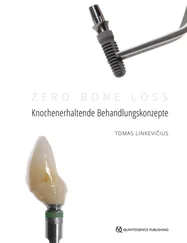 Tomas Linkevičius - Zero Bone Loss - Knochenerhaltende Behandlungskonzepte