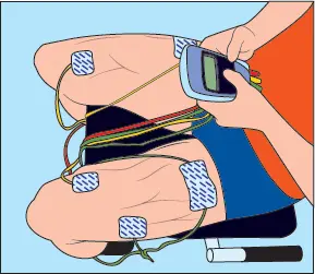 Trabajo de cuádriceps con electroestimulador Esta técnica ha ido evolucionando - фото 51