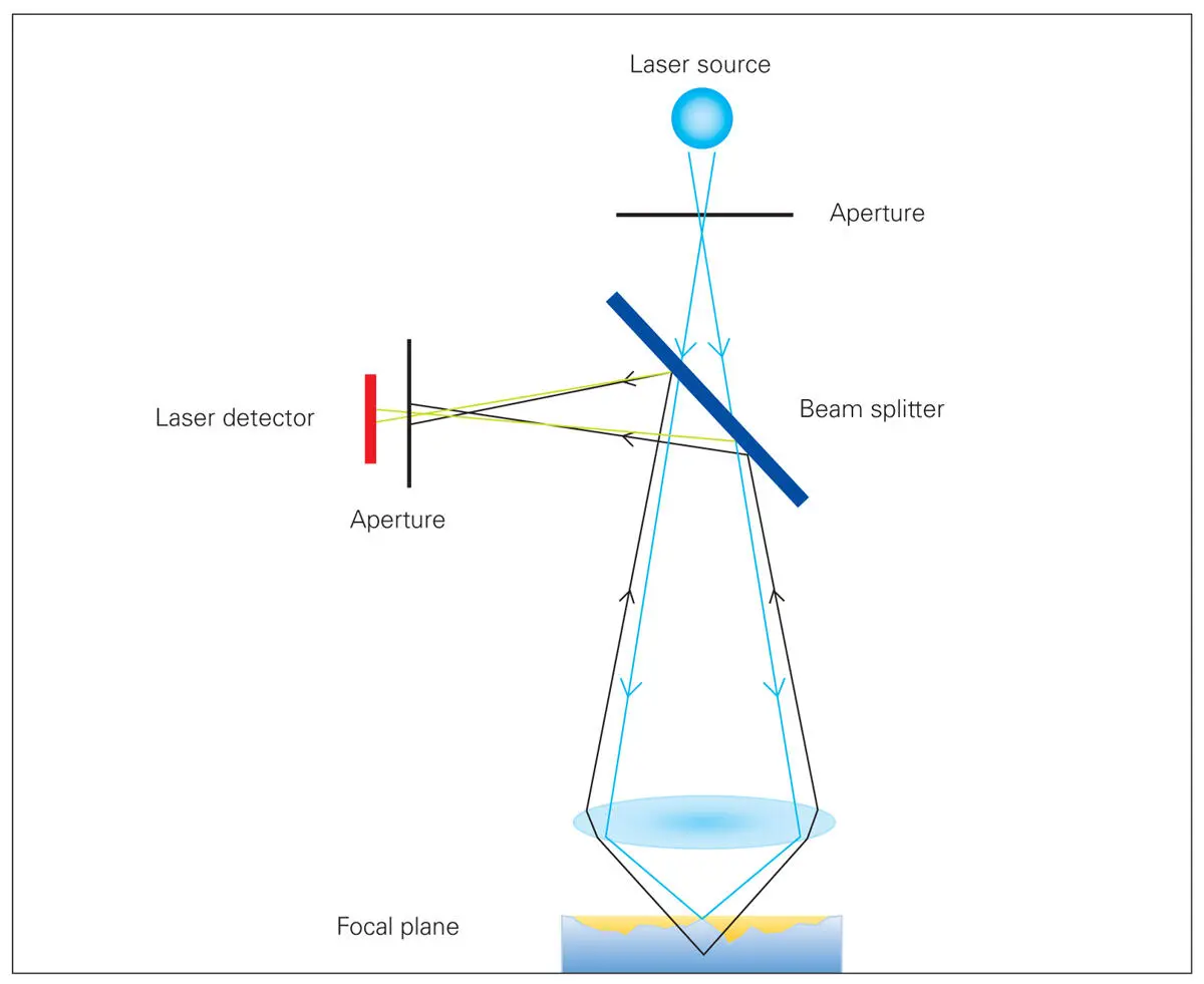 Fig 24A representative image of a confocal microscope 3D Progress MHT - фото 12